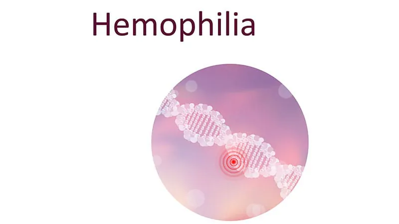 Europe edges closer to approving a new hemophilia A prophylaxis option