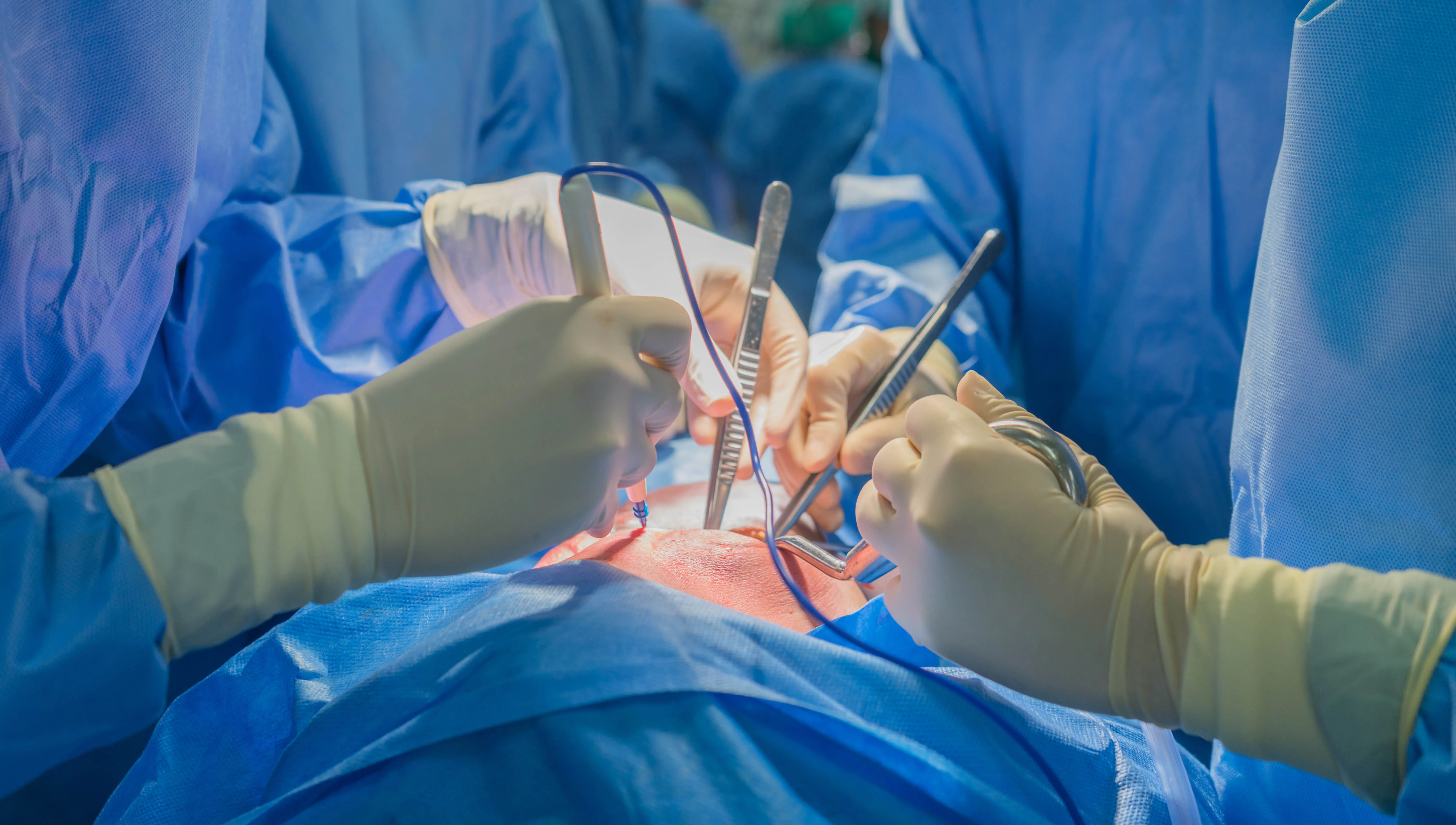 DCD heart transplants are scaling up — and outcomes are holding steady