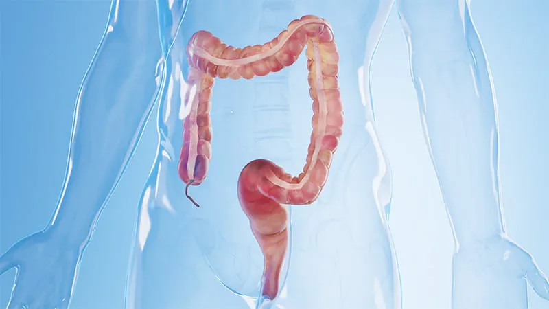A simple blood protein could predict severe Crohn's disease a decade early
