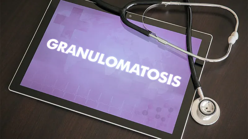 Paclitaxel-coated balloon shows promise for stubborn airway narrowing in rare autoimmune disease