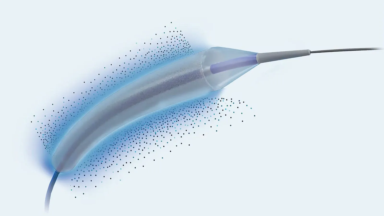 FDA approves second coronary drug-eluting balloon for in-stent restenosis