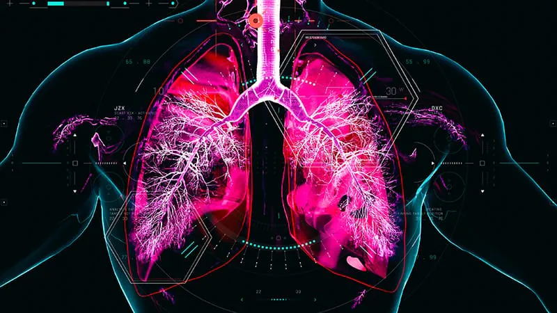 COPD care is getting a precision medicine makeover — and it starts before symptoms spiral