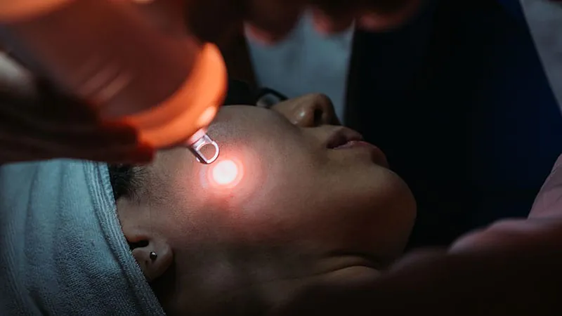 Laser safety in aesthetics: What every dermatologist needs to know about protecting eyes