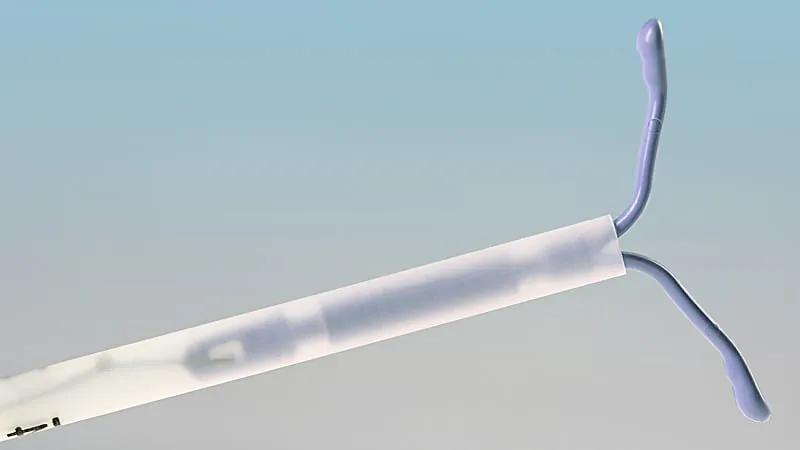 Better pain relief during IUD placement is within reach — here's what two new studies found