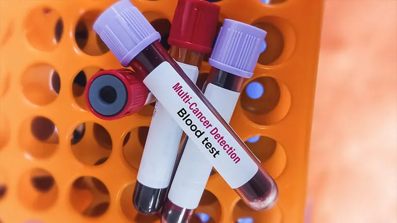 FDA panel backs Grail's Galleri blood test — but with major caveats