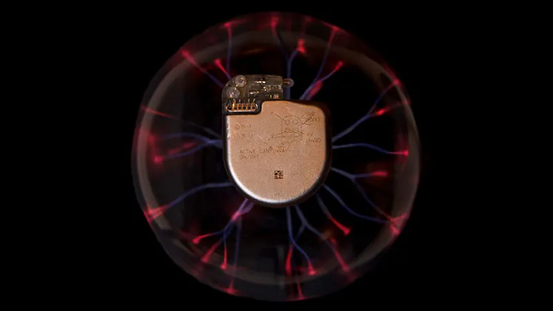 Extravascular defibrillator proves safe and effective in global real-world study