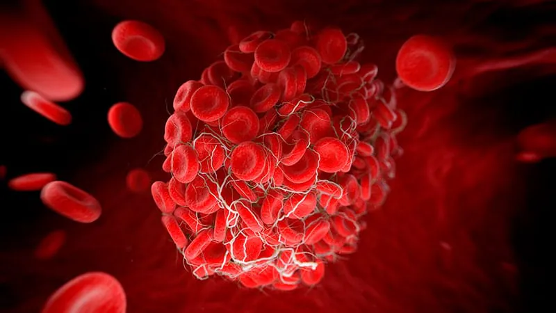 Not all menopause hormone therapy is created equal when it comes to clot risk