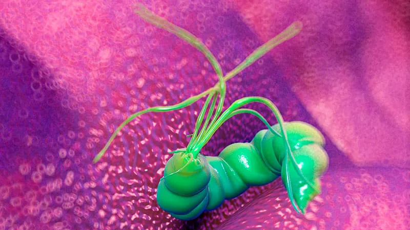 Catching more H. pylori: Why one test isn't enough for bleeding ulcer patients