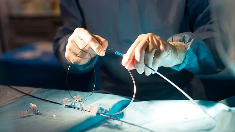 Thrombectomy beats medical management alone for large-core stroke patients transferred between hospitals
