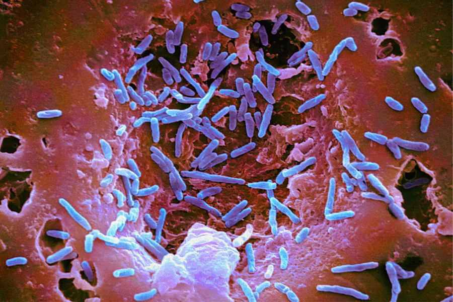 Tiny Health raises $33M to bring gut microbiome testing mainstream
