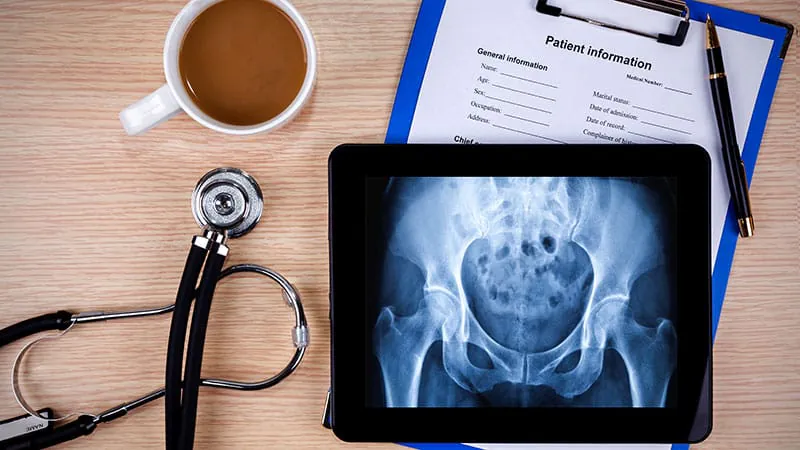 Screen overload: How EHRs and digital alerts are burning out hospitalists