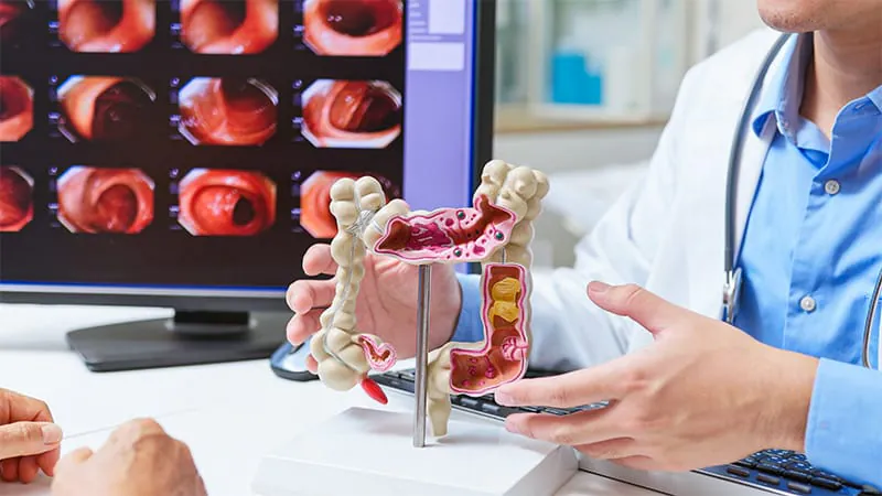 Many patients with low-risk polyps are getting colonoscopies too soon