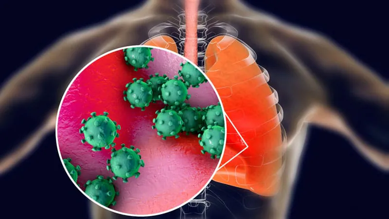 CAR T-cell therapy patients face high risk of respiratory viral infections long after treatment