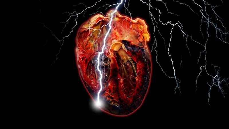 Heart failure cases worldwide have more than doubled since 1990