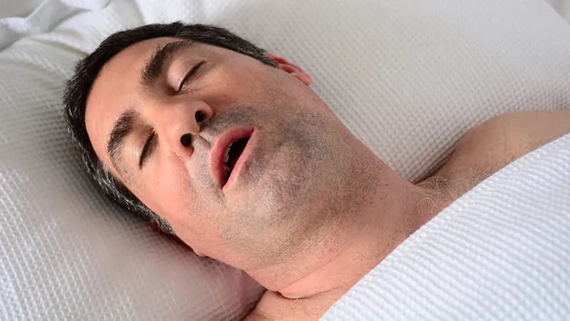 Sleep apnea is hiding in plain sight among psychiatric patients