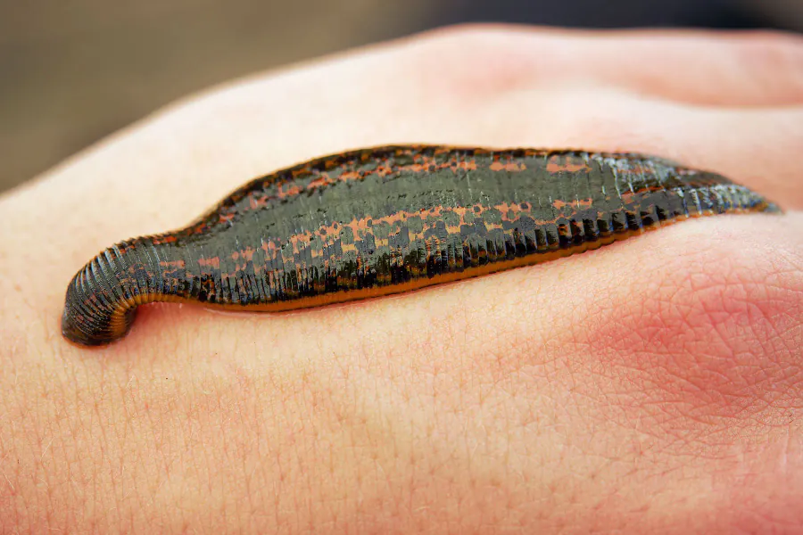 From cure-all to comeback: The surprising medical history of leeches