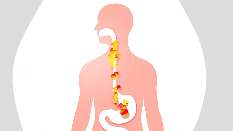 New acid blocker beats standard reflux drug on symptom speed — but not healing