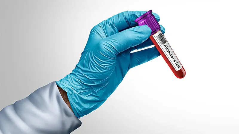 Early Alzheimer's blood tests sharpen diagnoses and drive better care decisions