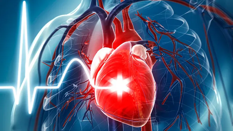 High pulmonary artery pressure at 24 hours predicts worse survival on VA ECMO
