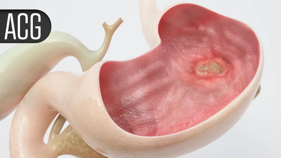 A new enzyme supplement could make life easier for IBS patients