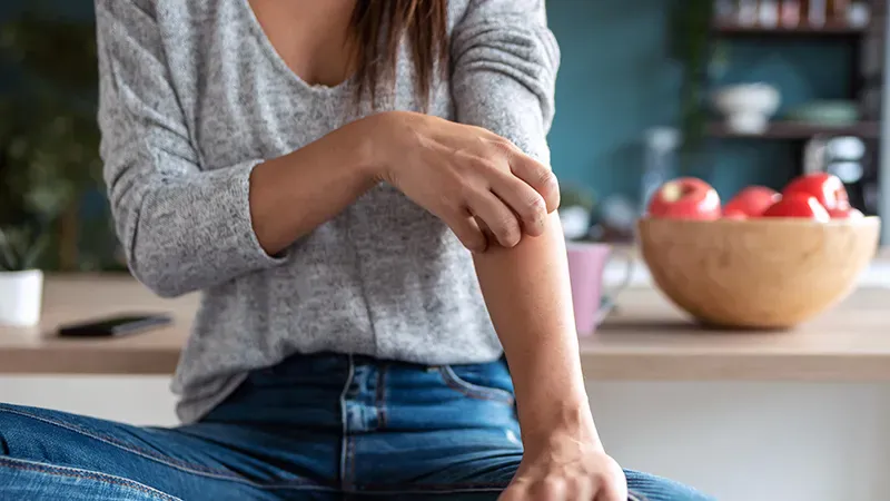 Gold allergy is surprisingly common in dermatitis patients — but it won't predict autoimmune disease