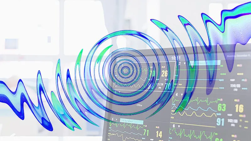 Radar tech is getting closer to replacing contact-based vital sign monitors