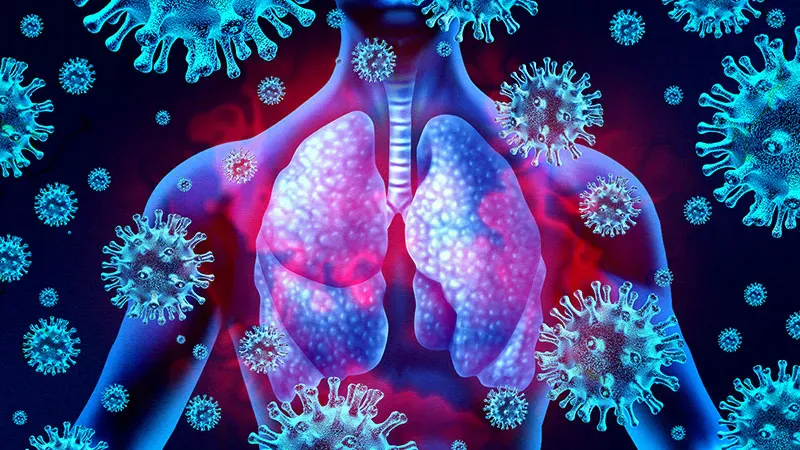 Letermovir keeps CMV at bay in high-risk lung transplant patients