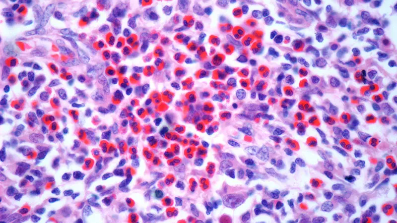 Smarter steroid use in COPD: eosinophil-guided therapy cuts ICS doses without raising risks