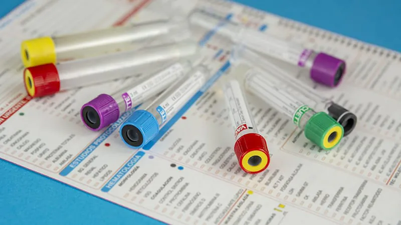 Upgraded blood test for colorectal cancer gets better at catching precancerous lesions