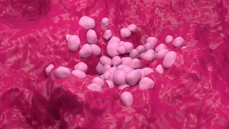 Lung cancer in teens: rare, often missed, and biologically distinct