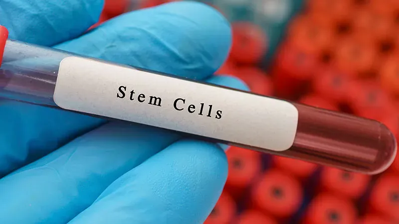 EMA confirms rejection of narsoplimab for stem cell transplant complication