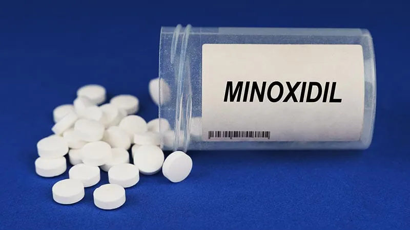 A new oral minoxidil pill could be the biggest hair loss breakthrough in 30 years
