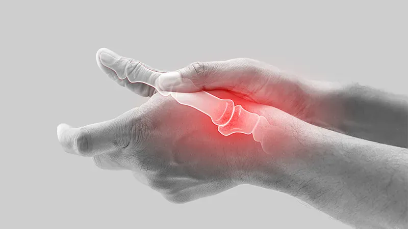 Tapering RA medications works just as well as staying on full dose, study finds
