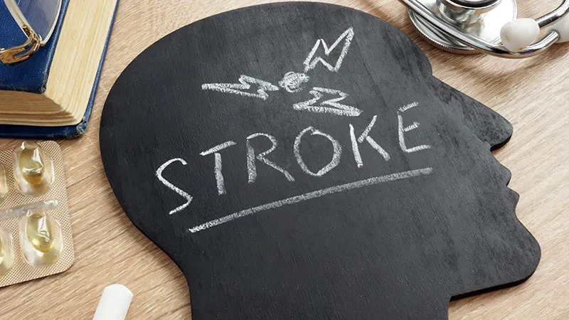 Intracranial stenting after failed thrombectomy shows promise as a stroke rescue strategy