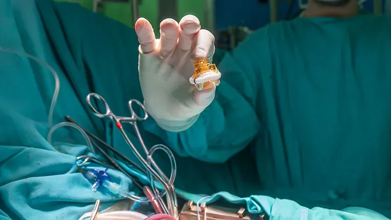 Transcatheter valve-in-valve therapy shows promise for high-risk mitral patients