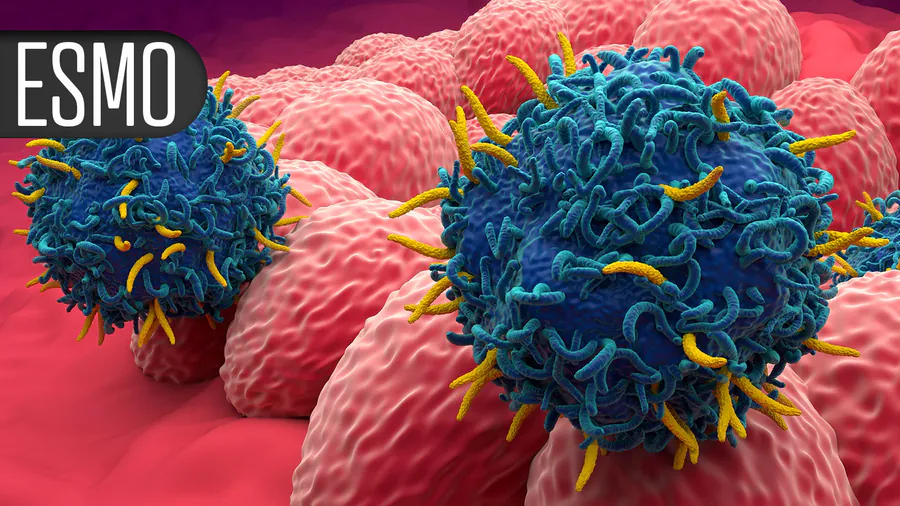 Adding darolutamide to standard prostate cancer treatment cuts metastasis risk nearly in half