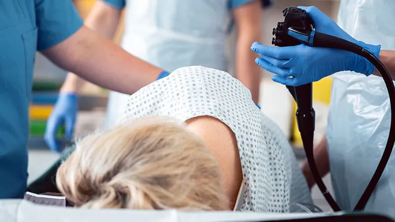 ASGE releases updated playbook for lower GI bleeding management