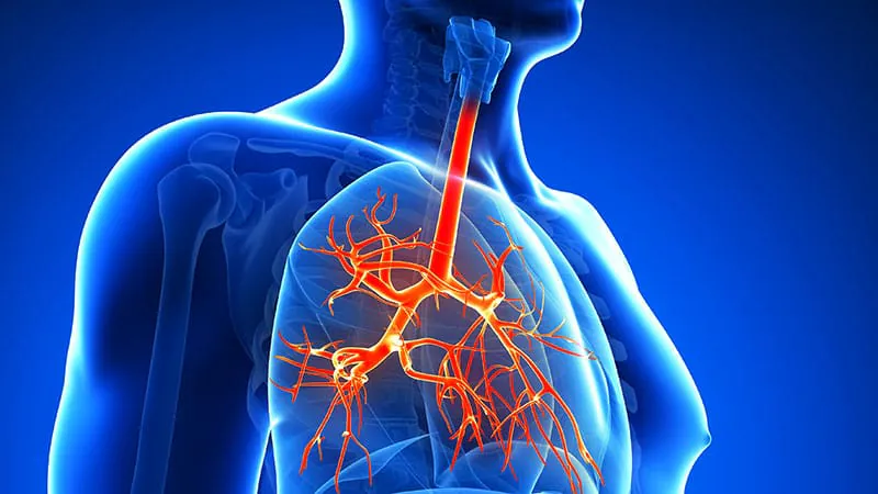 Electric pulse therapy shows lasting relief for chronic bronchitis — even without hitting its main target