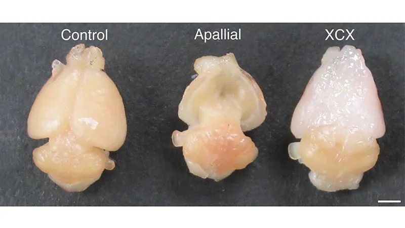 Human brain organoids transplanted into mice open new doors for neurological disease research