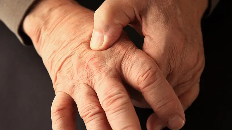 Rheumatoid arthritis remission is faster than ever — but staying in remission is harder