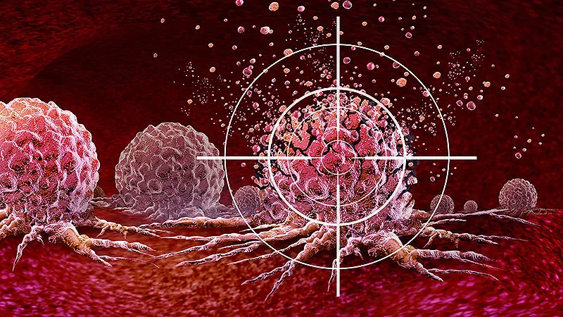 Osimertinib + savolitinib sets a new standard of care for MET-driven lung cancer