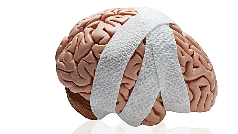 CT scans may predict brain death in non-traumatic acute brain injury patients