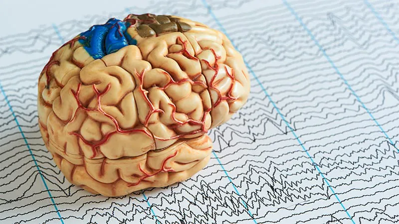 Late-onset epilepsy may be your brain's red flag for vascular disease