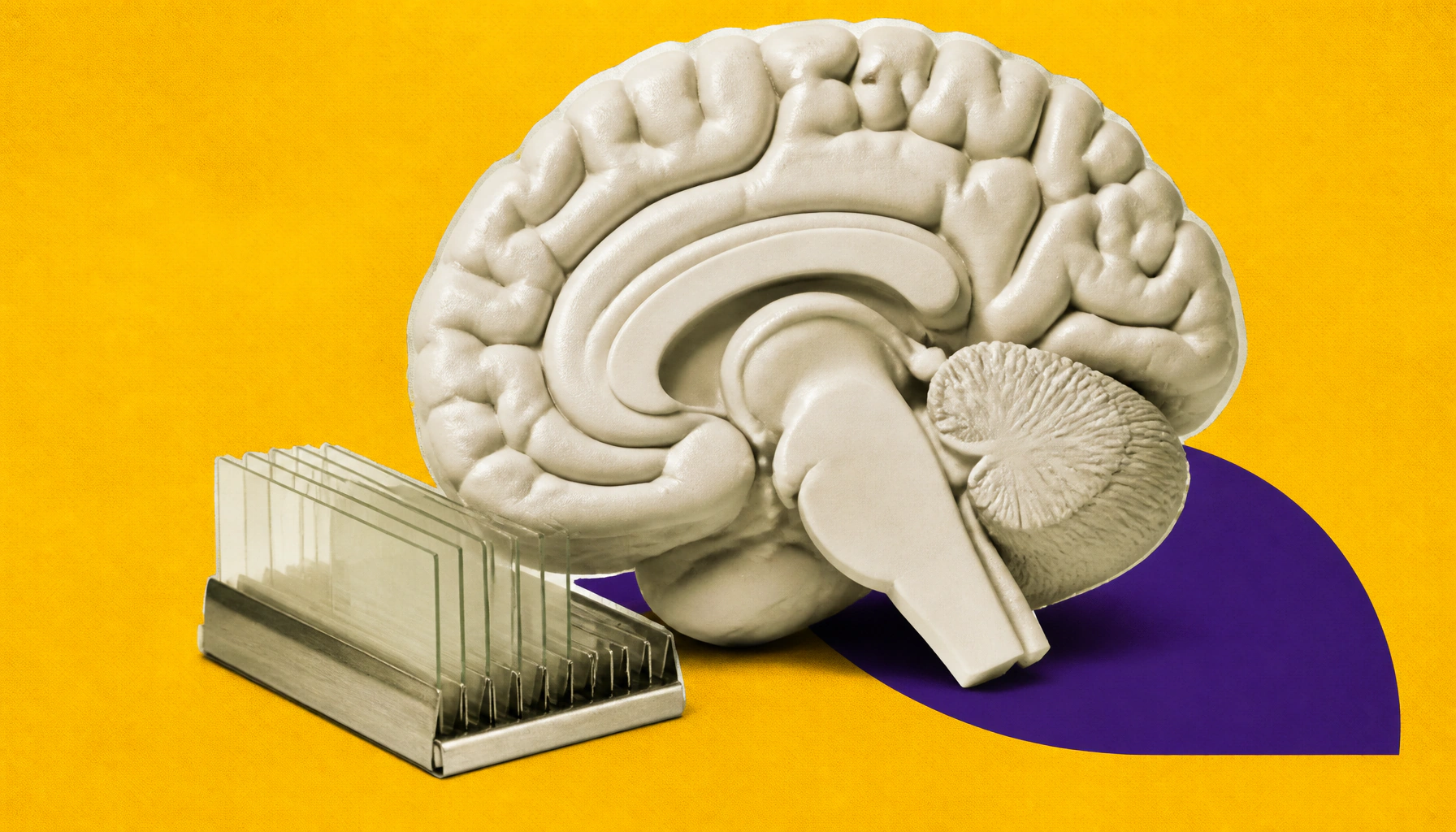 Why some brains stay sharp despite Alzheimer's — and what that means for treatment