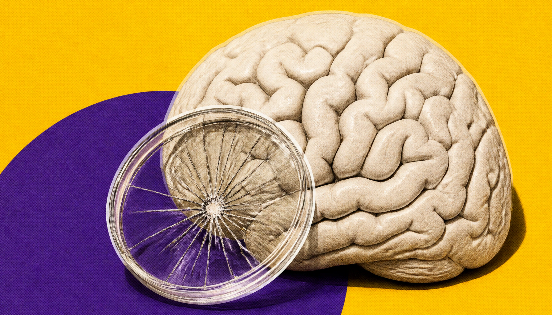 A hidden brain cell killer may finally explain Alzheimer's neuron loss