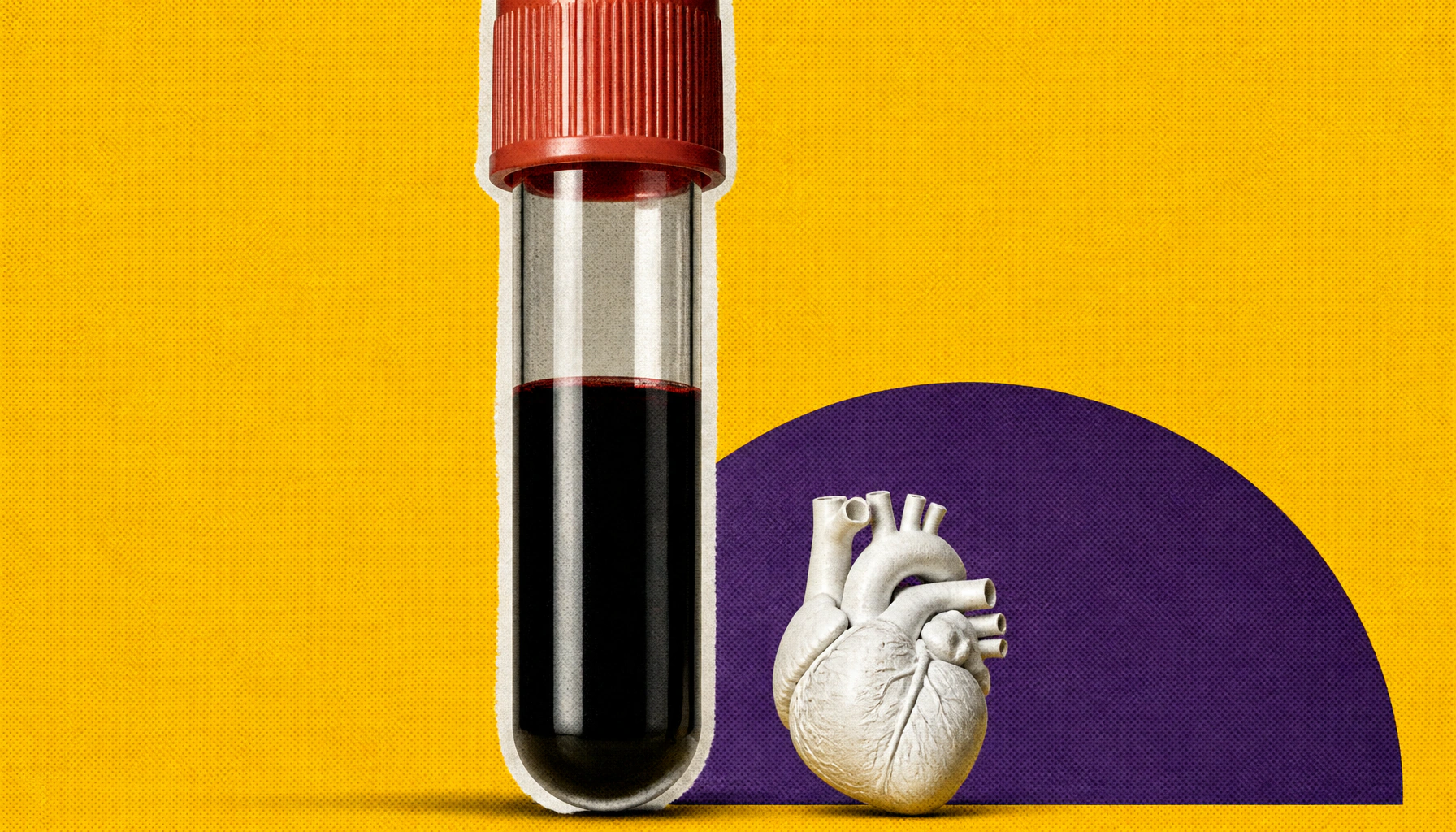 Is apoB the cholesterol test we should all be getting?