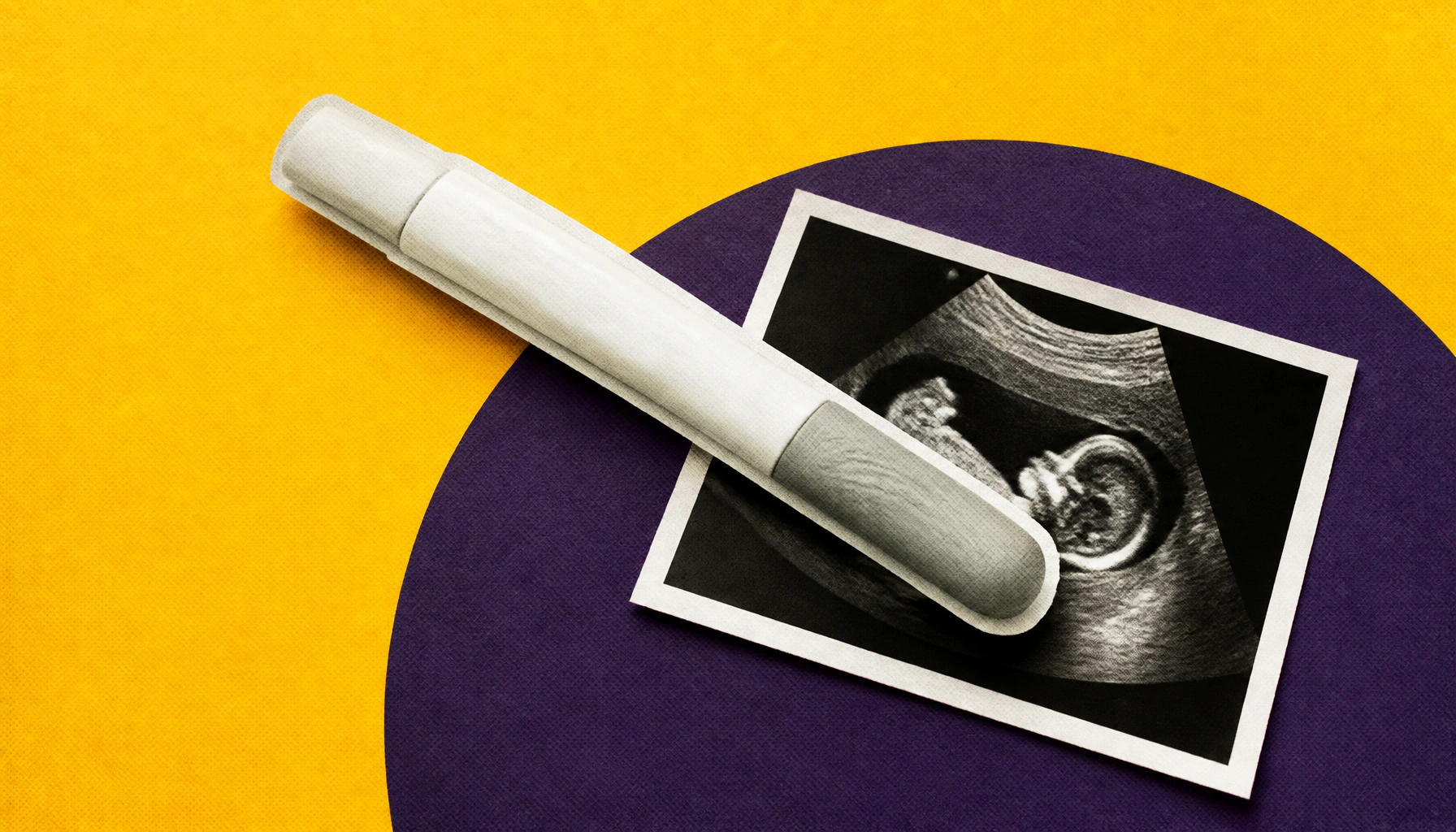 Biologic therapies for IBD are safe to continue during pregnancy, meta-analysis confirms