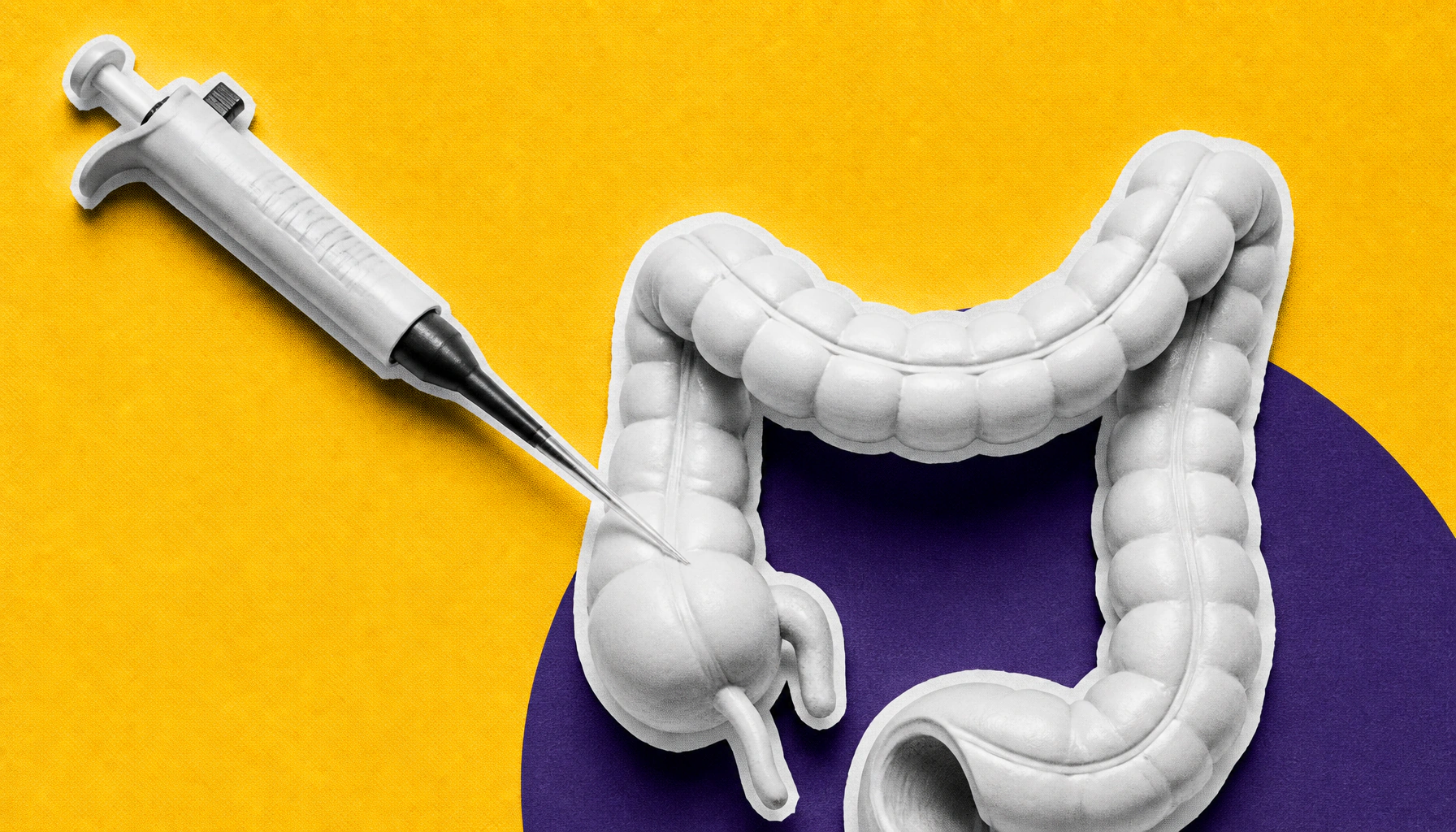 A molecular "identity switch" may hold the key to stopping colorectal cancer from spreading