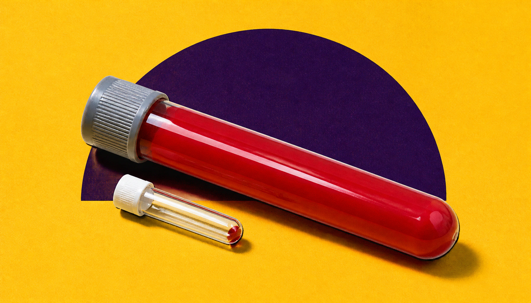 ASD and ADHD show opposite immune profiles, new meta-analysis finds
