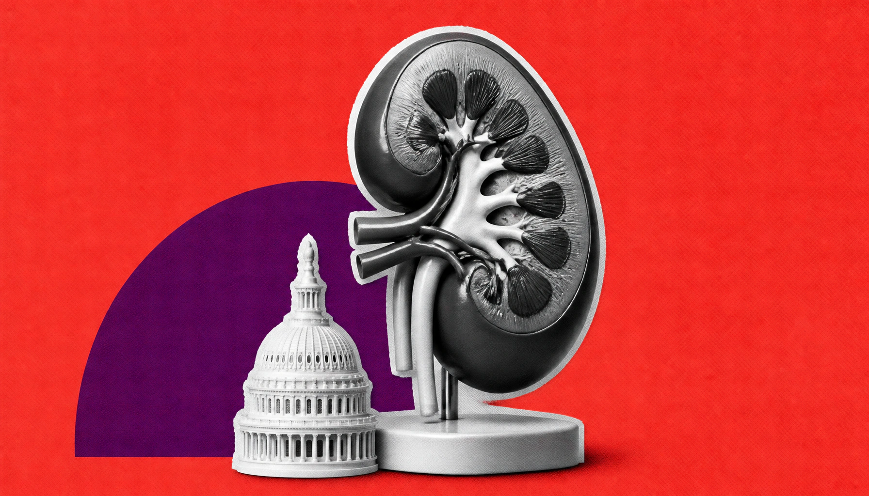What the new LEAD model means for the future of value-based kidney care
